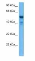 UGT2B17 antibody