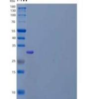小鼠多配体蛋白聚糖结合蛋白1/Syntenin-1/SDCBP重组蛋白C-6His