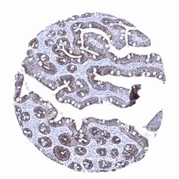 Hepatocyte Specific Antigen an