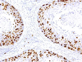 Ki67 antibody [IHC067]