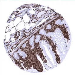 Vimentin antibody [MSVA-458R] 