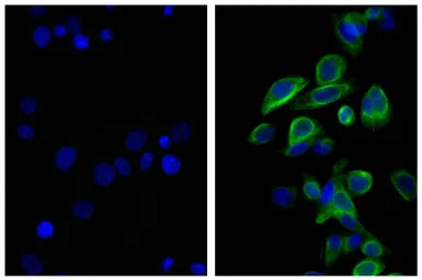 Rat Anti-Mouse IgG2b antibody 