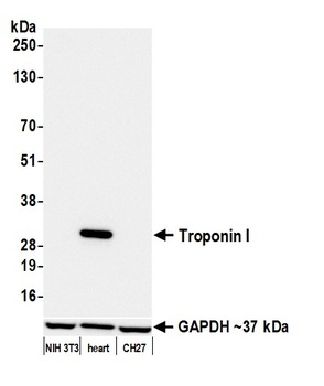 Troponin I Antibody 抗体，orb1806