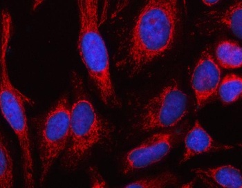 Anti-MSLNL Antibody 抗体，orb1786