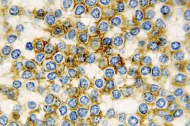 CD11c antibody [5D11]