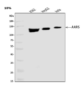 Alars Verbage AlaRS/AARS1 Antibody 抗体,orb763104,Biorbyt价格_品牌:Biorbyt-丁香通