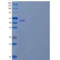 人含有锌指和BTB结构域的蛋白9/ZBTB9重组蛋白C-6His