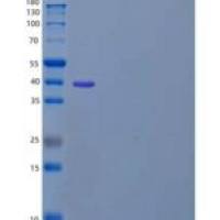 人b和T淋巴细胞衰减因子/BTLA/CD272重组蛋白C-Fc