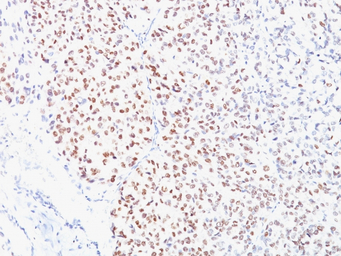 MITF antibody [D5]