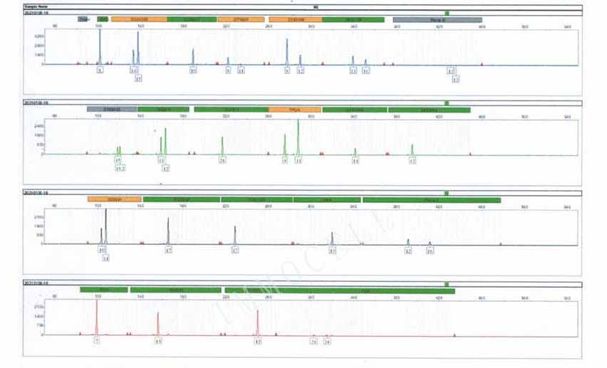 H1975细胞STR鉴定报告