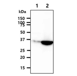 GPD1L antibody [AT14E2]