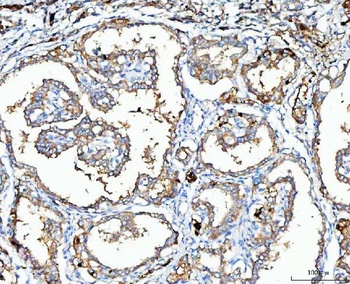 Anti-MGME1 Antibody 抗体，orb1743