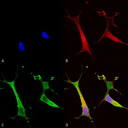 ATP7b antibody [S62-29]