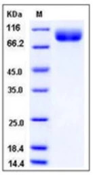 Human BCHE protein, His tag (a