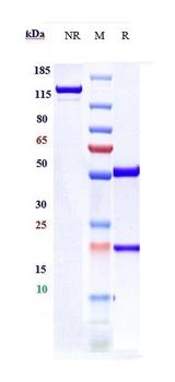 Anti-TNFRSF18 / GITR / CD357 R