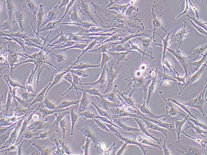 SNB-19人胶质瘤细胞图片