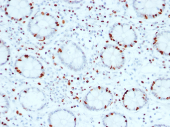 SOX4 antibody [SOX4/2540]