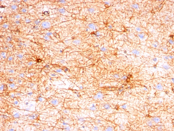 GFAP antibody [SPM507]