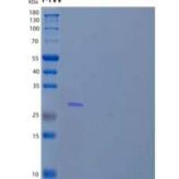 人锌指C4H2结构域蛋白/ZC4H2/HCA127重组蛋白N-6His