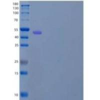 小鼠Serpin G1/C1重组蛋白C-6His
