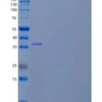 人胞质磺基转移酶家族1B成员1重组蛋白