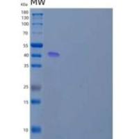 人前列腺酸性磷酸酶/ACPP重组蛋白C-6His