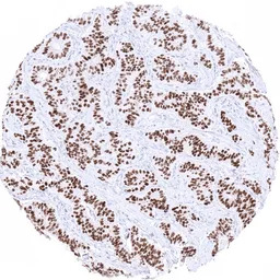 INSM1 antibody [MSVA-456R] His