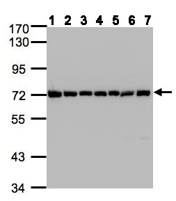 Rabbit anti Human HSP70 Polycl