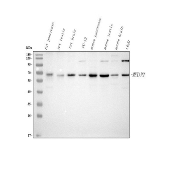 Anti-METAP2 Antibody 抗体，orb178