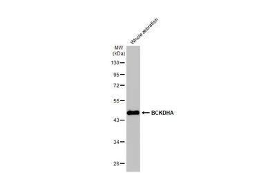 BCKDHA antibody [HL2405]