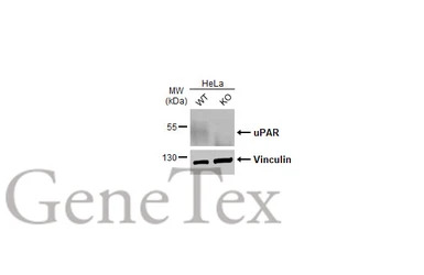 uPAR antibody [HL2169]