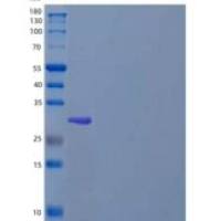 人ATP结合盒转运蛋白B5(ABCB5)重组蛋白N-Trx