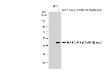 SARS-CoV-2 (COVID-19) nsp3 ant