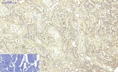 ABCB5 antibody [11A2]