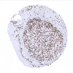 Ki67 antibody [MSVA-267M] Hist