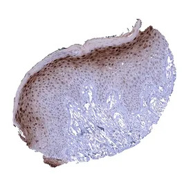 Cystatin A antibody [MSVA-461M