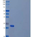 人白介素20(IL20)重组蛋白