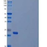 人白介素20(IL20)重组蛋白