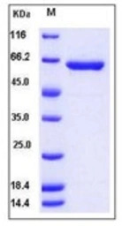 Human HEXA protein, His tag (a