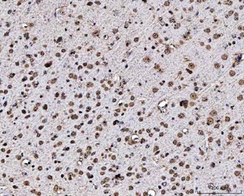 Anti-MATR3 Antibody 抗体，orb1786