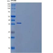 小鼠乳酸脱氢酶A/LDH1(LDHA)重组蛋白C-6His