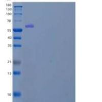 人核蛋白亚单位α-2 /KPNA2/IPOA1重组蛋白N-6His