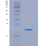人白介素1家族成员9(IL1F9)重组蛋白