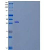 人乳酸脱氢酶B(LDHB)重组蛋白N-6His