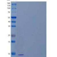 人环磷酸腺苷依赖性蛋白激酶抑制剂β/PKI-β重组蛋白N-6His