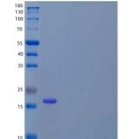人富含亮氨酸重复序列的蛋白质25/LRRC25重组蛋白C-6His