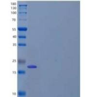 人γ-谷氨酰环转移酶重组蛋白