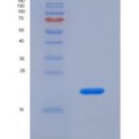 人延胡索酸酶(FUM)重组蛋白