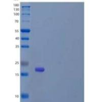 小鼠组织金属蛋白酶抑制因子1(TIMP1)重组蛋白