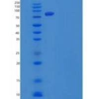 人n-乙酰半乳糖胺转移酶7/GALNT7重组蛋白C-6His